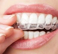 Revisión de la ortodoncia 'Hágalo usted mismo' | Diamond Braces