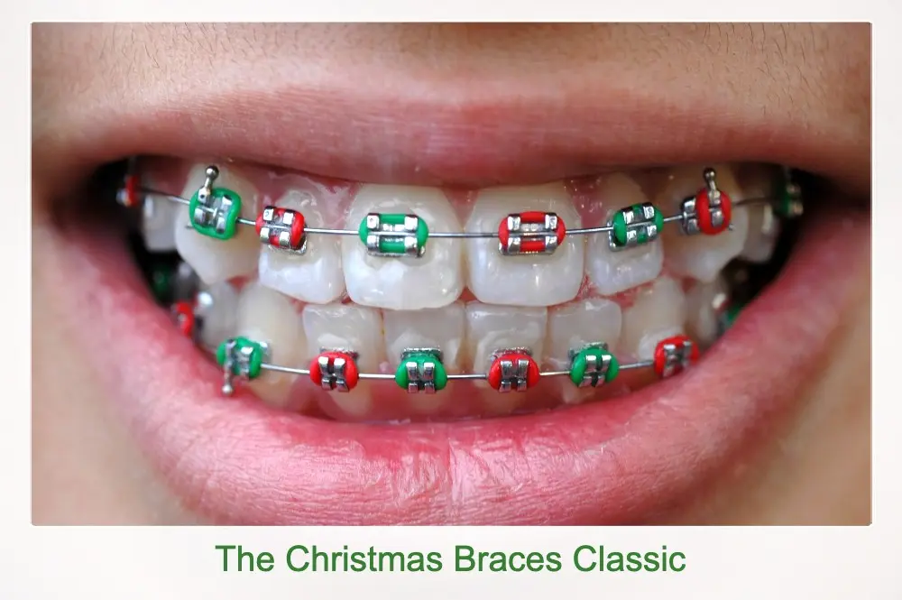 Clásico de Navidad para Brackets