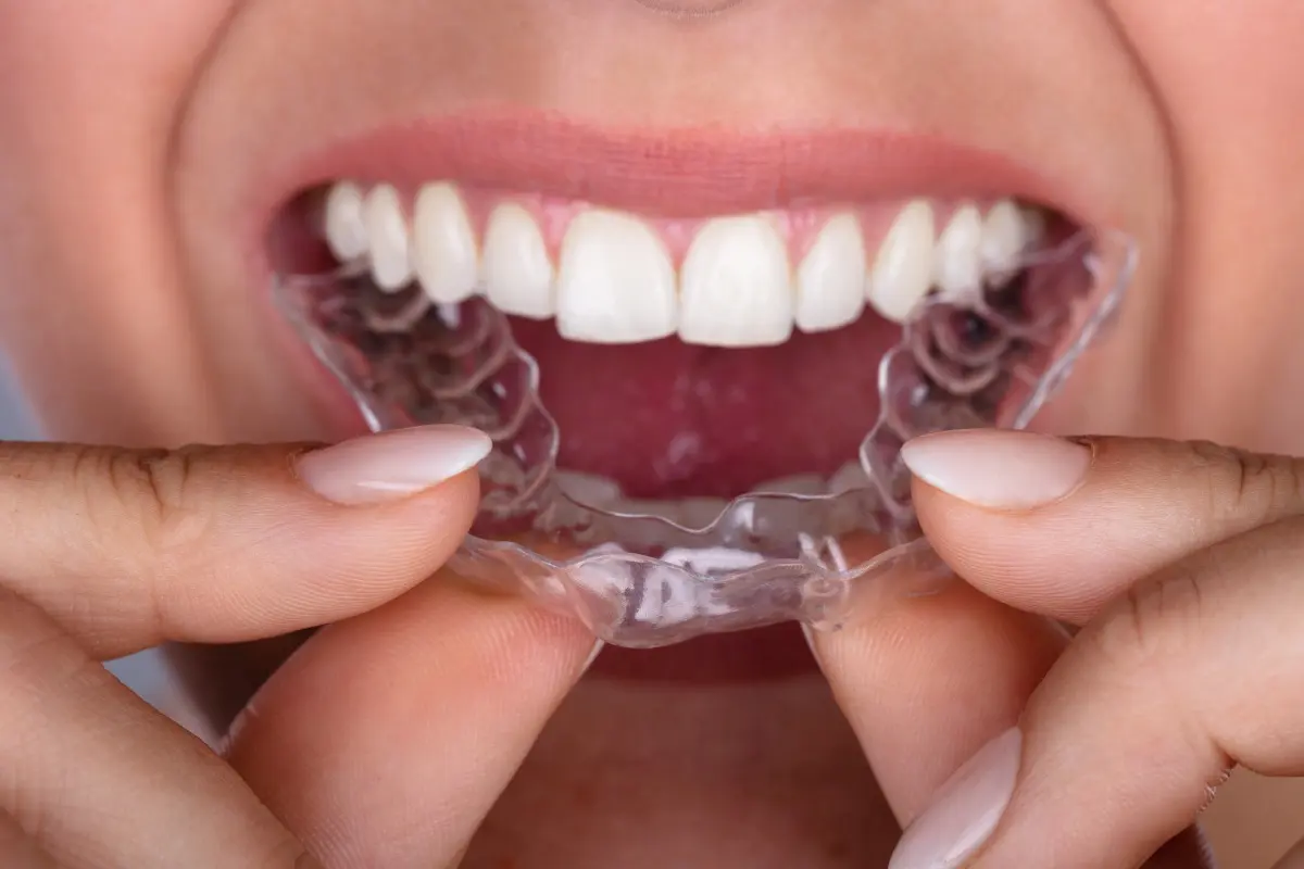 Person Wearing Clear Plastic Retainers