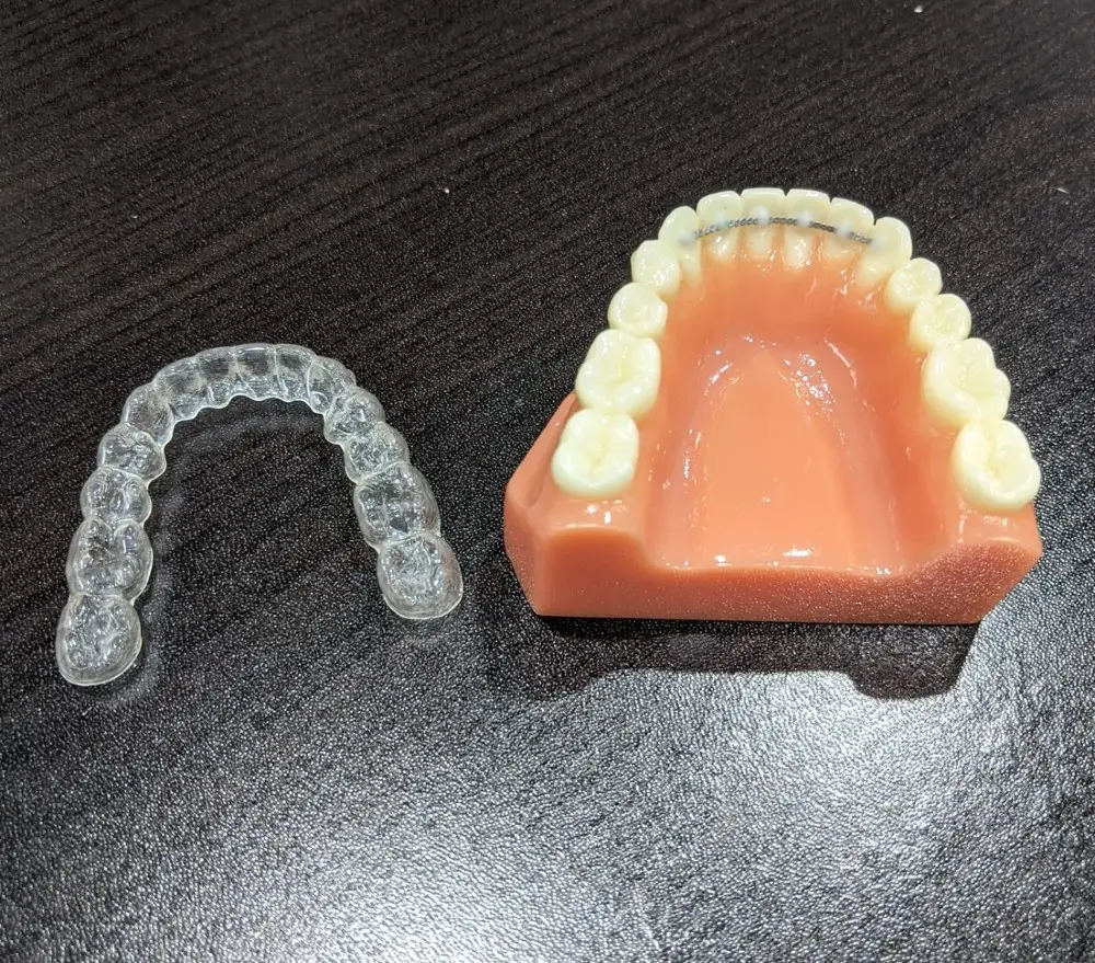 video Essix Retainer Cost, Care, Benefits, How it Works