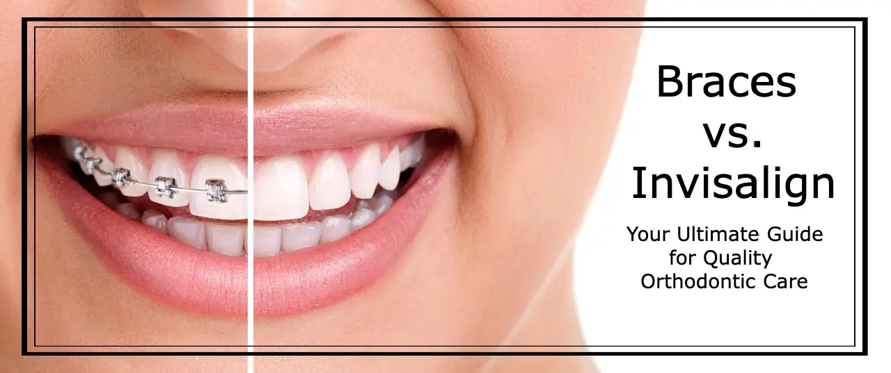 What's the cost difference between traditional braces and Invisalign? «  Smiles by White