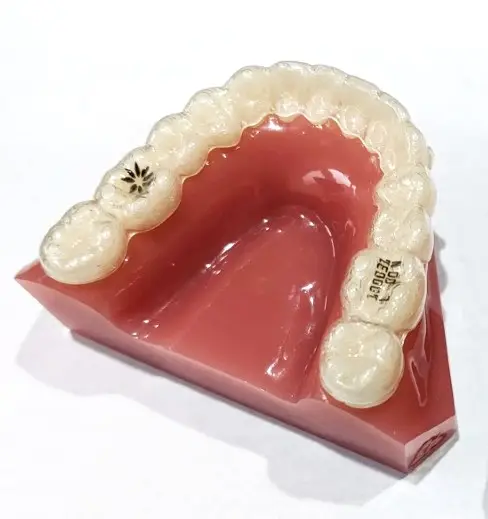 WHAT IS THE  Clear Removable Retainers