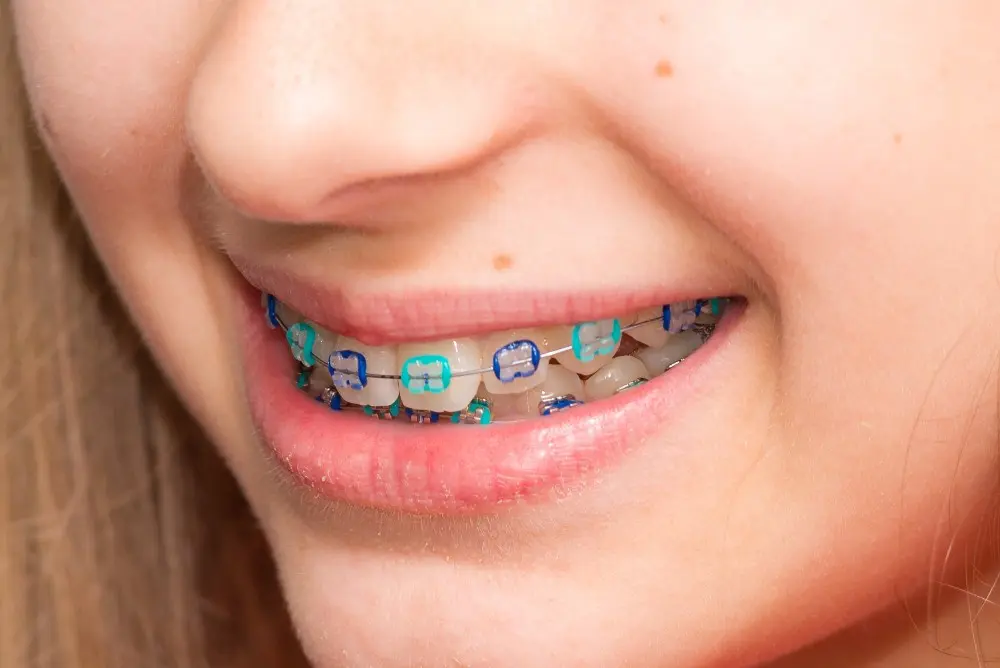 Patient smiling with colorful braces