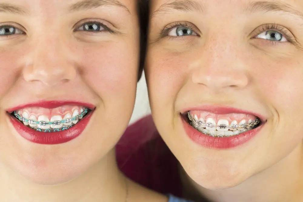 red colored braces