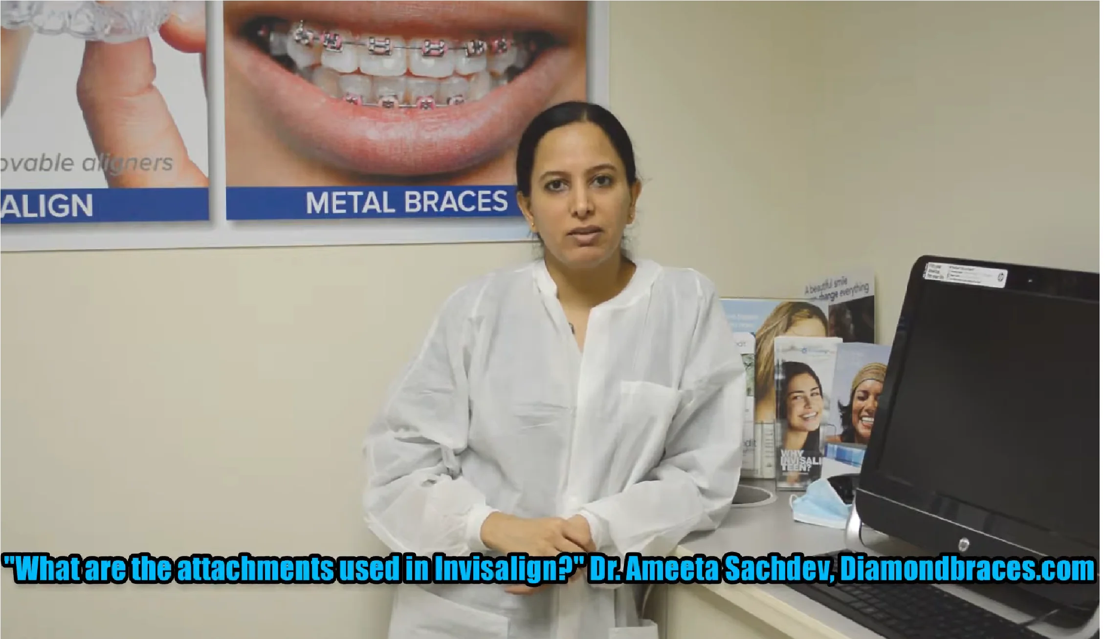 Invisalign attachments are far less noticeable than metal braces. They