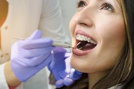 Diamond Braces Orthodontist vs. Dentist: Which Should You Choose?