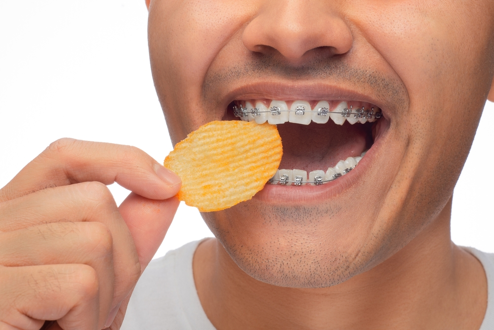 Crunch with Caution: A Guide to Eating Chips with Braces