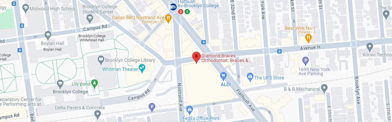 diamond braces 3010 avenue h brooklyn ny 11210 google map