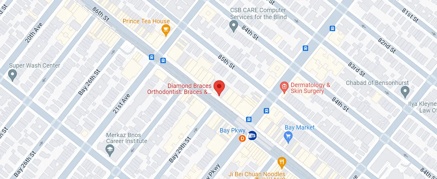 diamond braces bensonhurst brooklyn ny google map