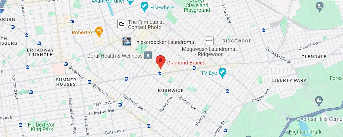 diamond braces knickerbocker ave brooklyn ny google map