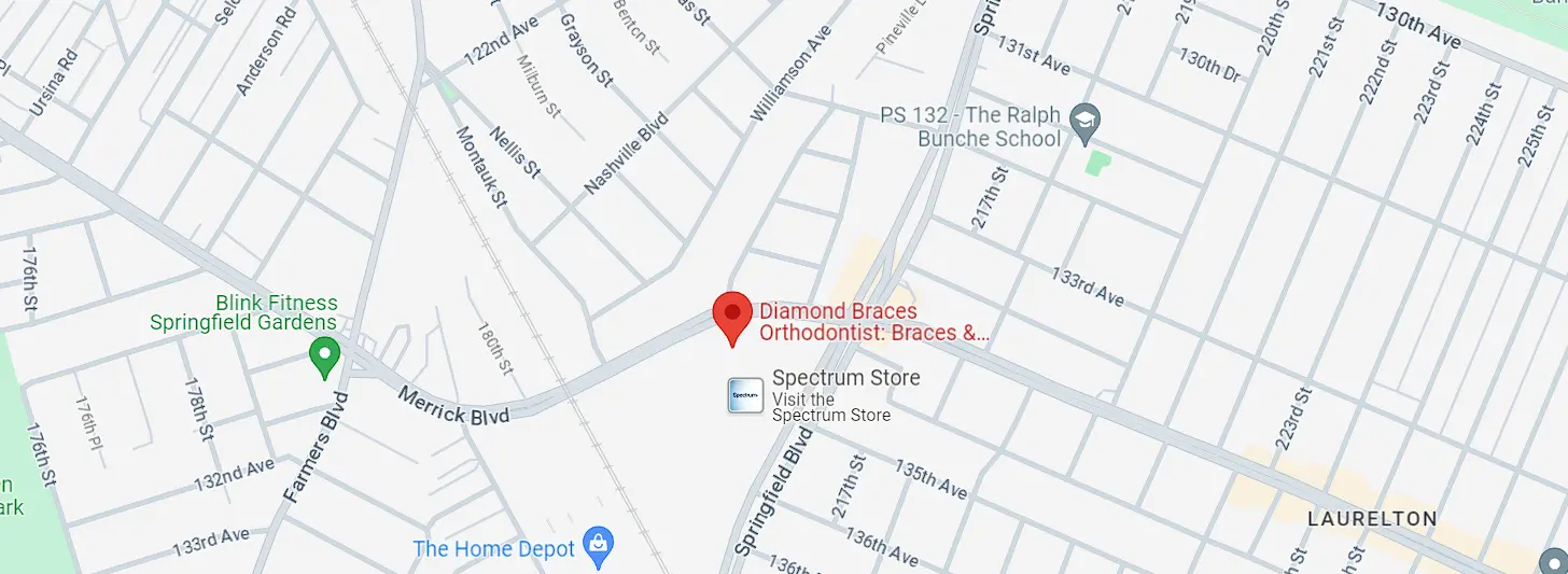 diamond braces springfield blvd queens google map