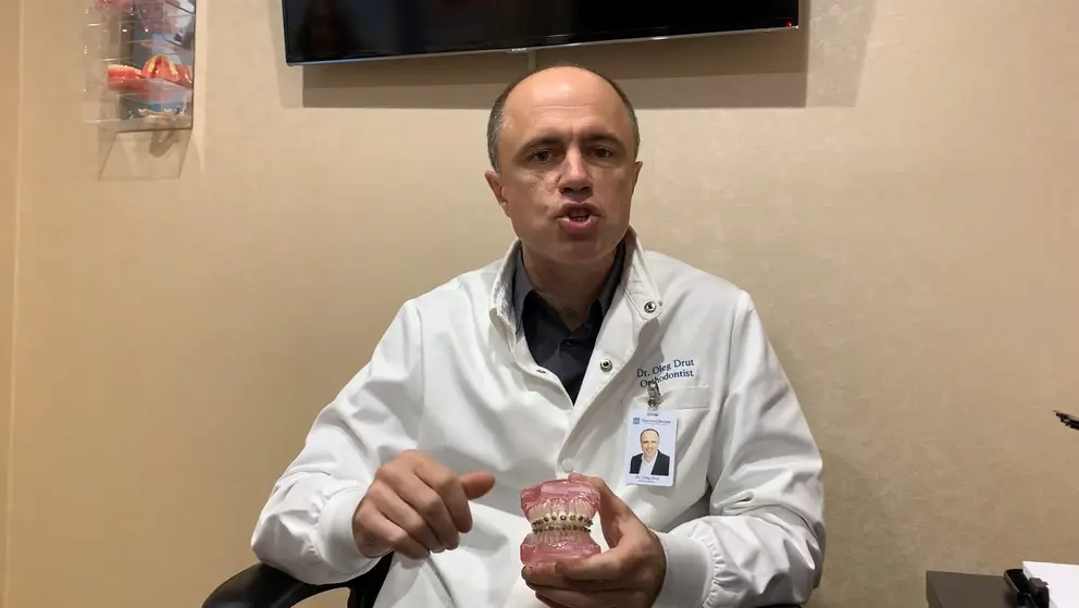 "Do It Yourself Orthodontics" Review Diamond Braces