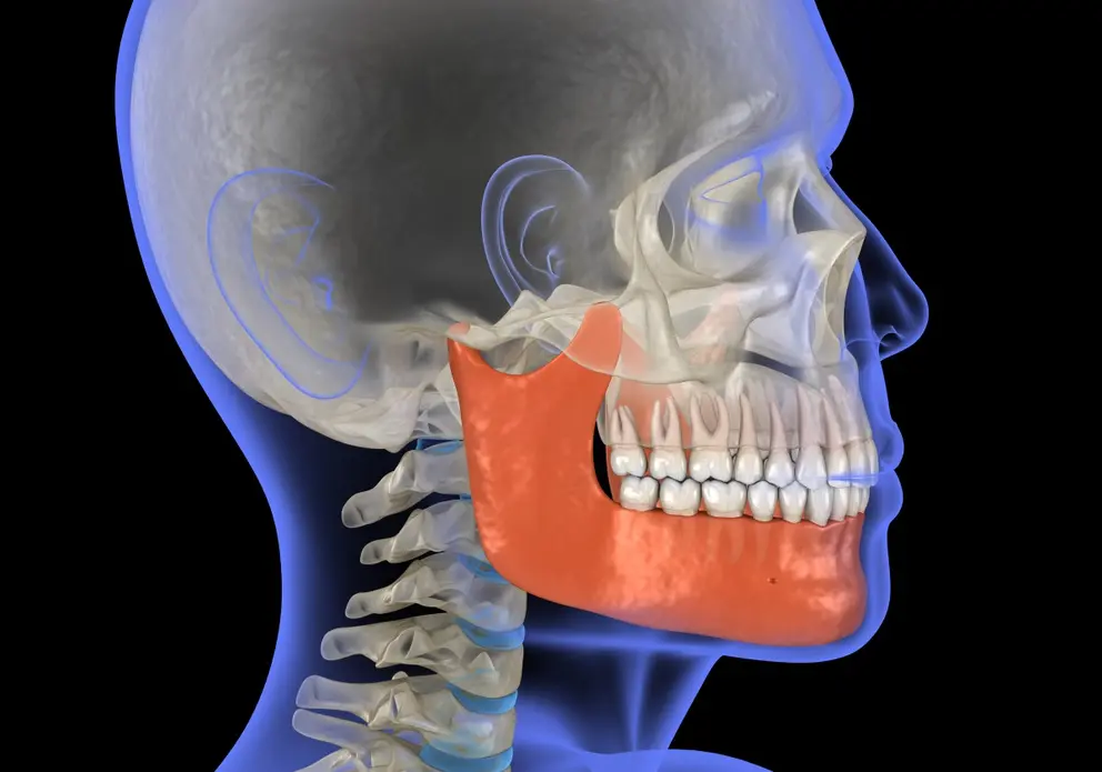 corregir problemas de mandíbula con alineadores transparentes