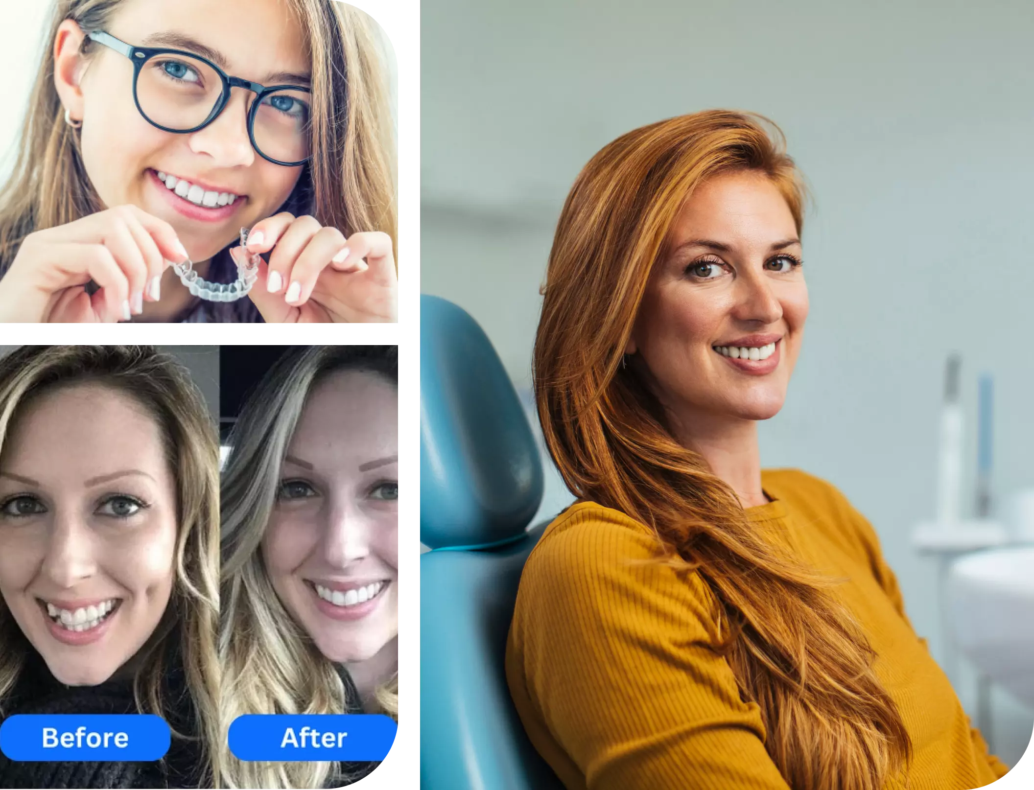 "Exclusive Braces & Invisalign Deals for Mount Sinai"