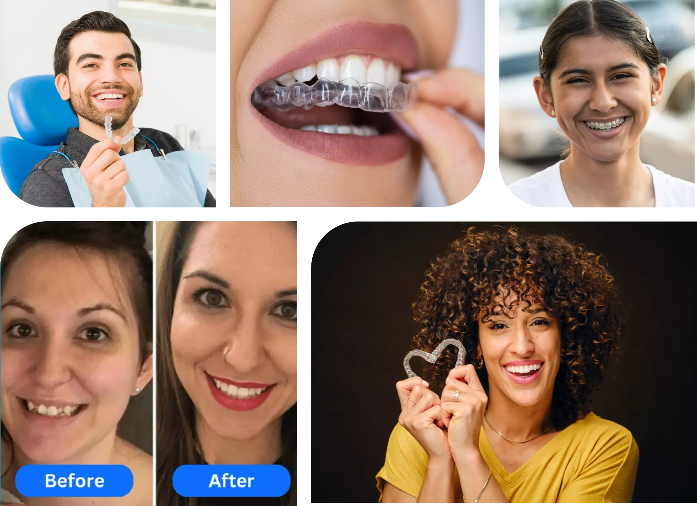 "Exclusive Braces & Invisalign Deals for Mount Sinai"
