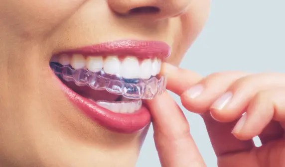 CAN A  Hawley Retainer Move Teeth