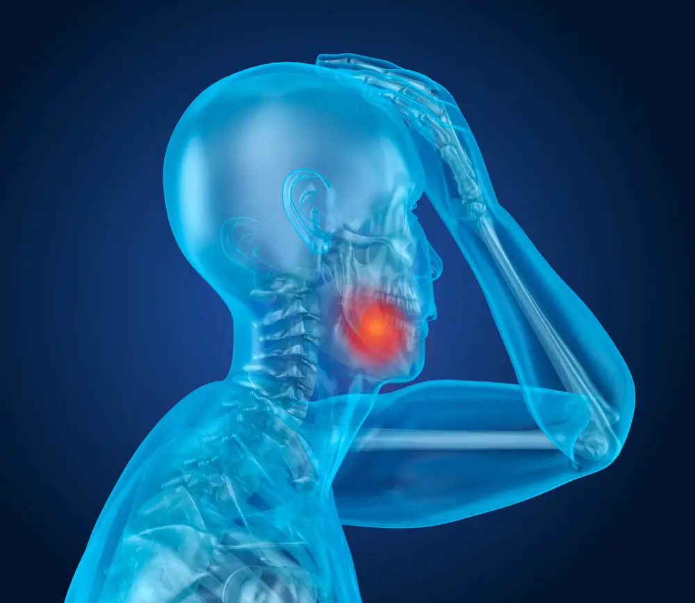 WHO NEEDS  Orthognathic Surgery