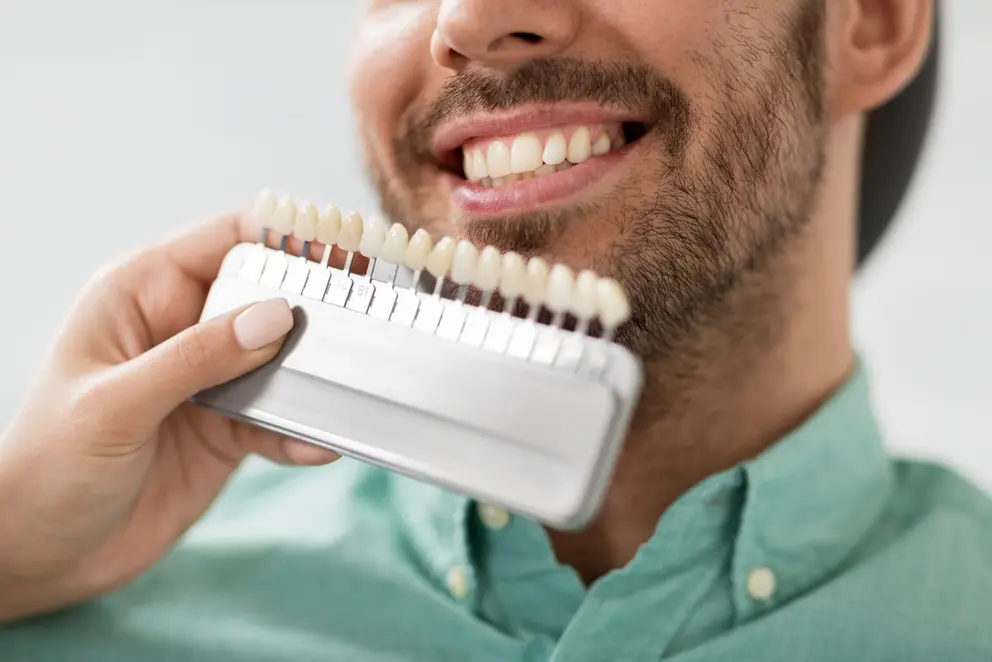 ¿TE PREGUNTAS SI Brackets O Carillas Son Mejores Para Tu Caso? Sigue Leyendo para Aprender Más