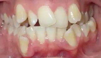 rsz orthodontists intraoral anterior
