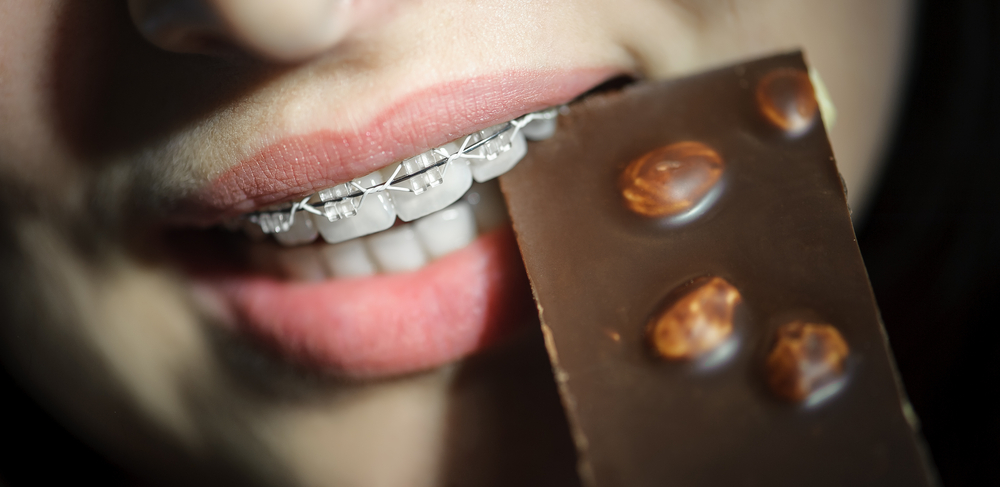 ¿Qué caramelos puedes comer con brackets