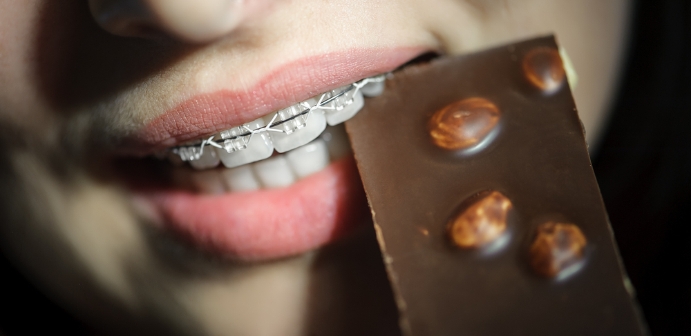 Satisfy Your Sweet Tooth: Braces-Friendly Candy Options