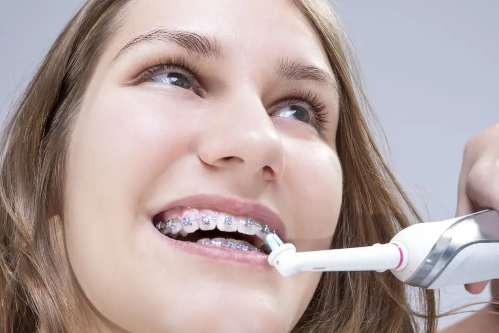Are Electric Toothbrushes Good for Braces?
